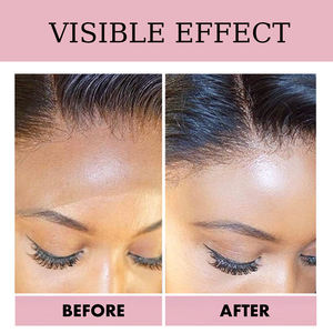 <span class=keywords><strong>Colle</strong></span> pour Perruque <span class=keywords><strong>en</strong></span> Dentelle Imperméable Résistante à la Sueur <span class=keywords><strong>Forte</strong></span> Adhérence <span class=keywords><strong>Spray</strong></span> 38ml 1.3oz <span class=keywords><strong>Colle</strong></span> pour Cheveux pour Perruque à Dentelle Frontale - Product Image 4