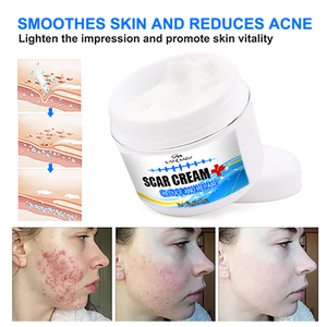 Best Sell Gel per la rimozione delle cicatrici trattamento per l'acne cicatrici sbiancanti crema Gel per la cura crema per il viso a base di erbe per adulti e lozione crema per la vitiligine - Product Image 3
