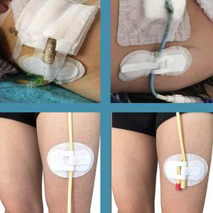 อุปกรณ์รักษาเสถียรภาพสายสวน <span class=keywords><strong>Foley</strong></span>, ที่ยึดสายสวนขากระเป๋าปัสสาวะแบบ Legband - Product Image 5