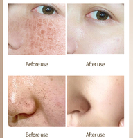 Gel facial micro-spicules avec éponge hydrolysée et 4-butylresorcinol, gel raffinant OEM ODM