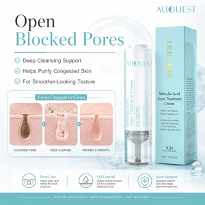 Crema OEM per il trattamento dell'acne con acido salicilico al 0,3%, riduce i punti neri e l'acne del <span class=keywords><strong>viso</strong></span>, controlla e elimina le imperfezioni. - Product Image 4