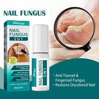 Sérum pour les ongles à base de plantes de marque privée South Moon, soin des ongles, crème liquide pour éliminer les champignons des ongles, lotion, traitement des champignons des ongles des pieds, huile