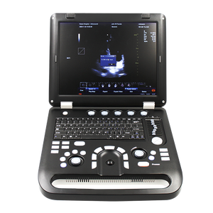 <span class=keywords><strong>Échographie</strong></span> <span class=keywords><strong>Doppler</strong></span> CONTEC CMS1700C <span class=keywords><strong>échographie</strong></span> portable pour ordinateur portable - Product Image 1