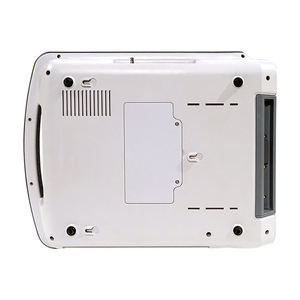 Monitor janin ultrasonik kompak profesional, peralatan elektronik kendali Panel depan sederhana - Product Image 4