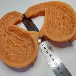 KyrenMed 3D modèle d'anastomose gastrique humaine modèle d'entraînement de l'estomac bivalve silicone grandeur nature pour la pratique de la chirurgie générale - Product Image 5