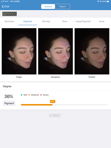 Intelligent Digital AI Beauty Magic Mirror Wood Lamp MC88 Facial Skin <span class=keywords><strong>Analyser</strong></span> Prediction <span class=keywords><strong>Equipment</strong></span> for Face for US JP ZA Plugs - Product Image 4