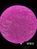 Lames de microscope en verre préparé de 100 pièces dans un boîtier en bois avec spécimens de plantes/botaniques, de bactéries et de champignons