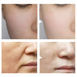 LYW 헥사펩타이드 히알루론산 세럼 30ml 집중 보습 및 매끄러운 피부결을 위한 영양 공급 및 정제된 피부 질감 - Product Image 5