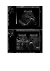 <span class=keywords><strong>2025</strong></span> Veterinaire Echografiescanner | Draagbare Diermachine Voor Vee/Paard/Huisdierenkliniek Met 3.5Mhz-Sonde - Product Image 3