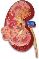 Reno normal y enfermo con perspectiva dual para patología, anatomía humana y educación CE/ISO