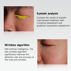 Machine d'analyse de la peau 3D <span class=keywords><strong>Dermatoscope</strong></span> IA Analyseur de peau du visage Scanner intelligent de visage à lumière UV pour spa et <span class=keywords><strong>salon</strong></span> de beauté - Product Image 5