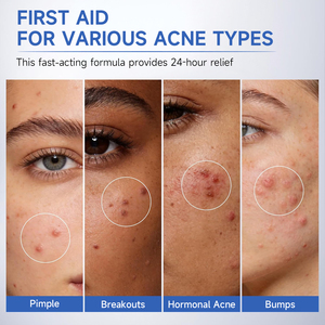 Crème apaisante 64% - Soin instantané contre l'acné - Apaise les peaux sensibles - Soin coréen pour la peau - Crème réparatrice contre l'acné à l'<span class=keywords><strong>acide</strong></span> <span class=keywords><strong>salicylique</strong></span> - Product Image 5