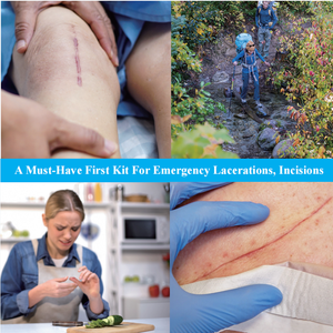 Trummed bướm đóng cửa bướm Dải bướm vết thương đóng cửa dải - Product Image 6