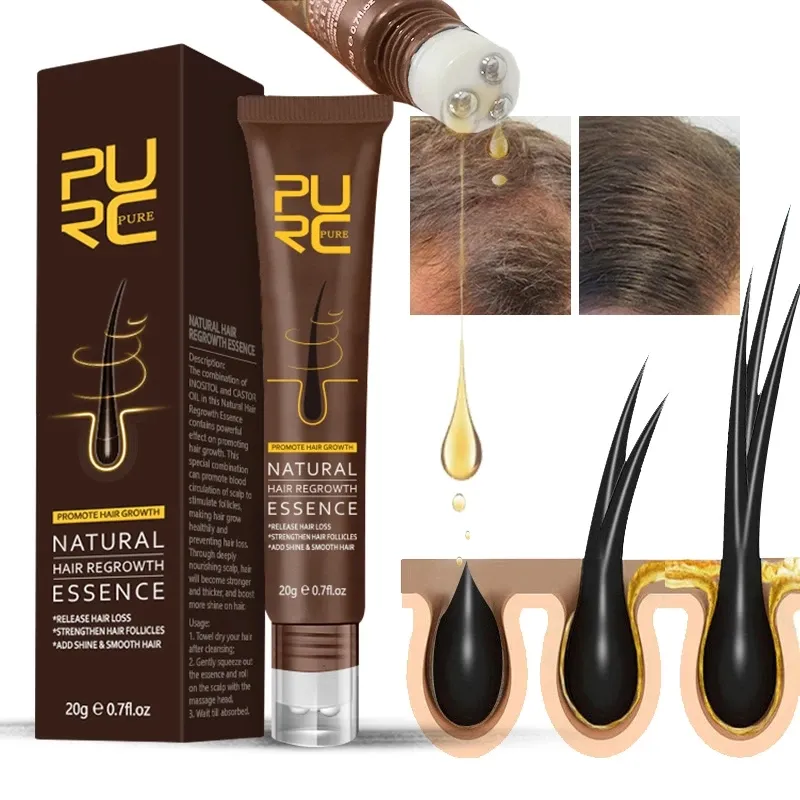Purc óleo de crescimento rápido para cabelo, tratamento de perda de cabelo extrato de gengibre cultivo produtos para cuidados com o cabelo e couro cabeludo