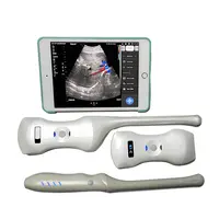 Android Ultrasound Probe for Hospitals - Alibaba.com