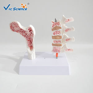 Modèle d'os pathologique en PVC pour l'ostéoporose avec carte dorsale - Modèle de <span class=keywords><strong>squelette</strong></span> <span class=keywords><strong>humain</strong></span> - Product Image 5