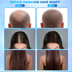 Kit Perawatan Rambut Anti rontok dan perawatan rambut kartu USB menyimpan Data analisis pengguna 5 in 1 AI kamera mesin penganalisa rambut kepala - Product Image 6