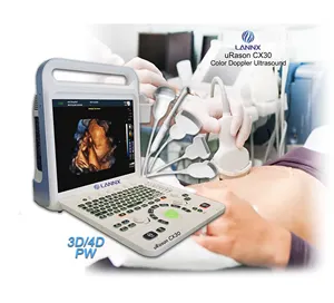 LANNX uRason CX30 nueva llegada 3D/4d color doppler ultrasonido ultrasónico escáner sistema de diagnóstico portátil máquina de ultrasonido