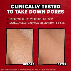 Tónico Facial <span class=keywords><strong>THAYERS</strong></span> Sin Alcohol con Pétalos de Rosa y Hamamelis para una Piel Radiante, Calmante, Hidratante y Refrescante para Todo Tipo de Piel - Product Image 5