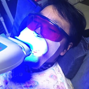 Masque facial dentaire en gaze pour soins bucco-dentaires et blanchiment des dents avec protection des lèvres - Product Image 6