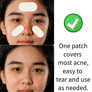 Parches Transparentes Hidrocoloides Invisibles de Gran Tamaño para el Acné, con Aceite de Árbol de Té, Tratamiento para Puntos y Manchas - Product Image 4