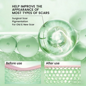 Crème de traitement des cicatrices à la camomille avancée, cliniquement testée pour les marques de brûlures, les cicatrices d'accidents, favorise la régénération - Product Image 5