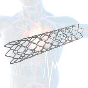 Rete in Nitinol Autodilatabile Intrecciata per <span class=keywords><strong>Stent</strong></span> Biliari nel Trattamento di Stenosi Maligne e Benigne - Product Image 1