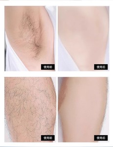 Dispositivo portátil de doble cara 2 en 1 para depilación y pulido de pies, borrador de depilación mágica de cristal físico - Product Image 5