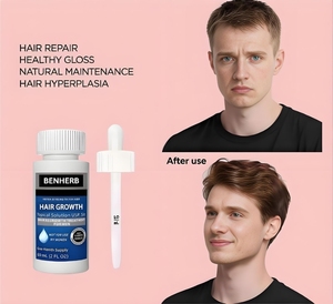 <span class=keywords><strong>Siero</strong></span> Naturale Biologico per la <span class=keywords><strong>Crescita</strong></span> dei <span class=keywords><strong>Capelli</strong></span> Formula 2-in-1 per Uomini e Donne <span class=keywords><strong>Capelli</strong></span> Ricci Protezione del Colore Nutriente Miglior Prezzo all'Ingrosso - Product Image 6