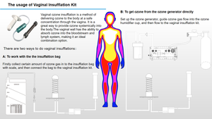 Sonde d'insertion pour la thérapie à l'ozone <span class=keywords><strong>vaginal</strong></span>, insufflation d'O3 avec port d'entrée et de sortie - Product Image 5