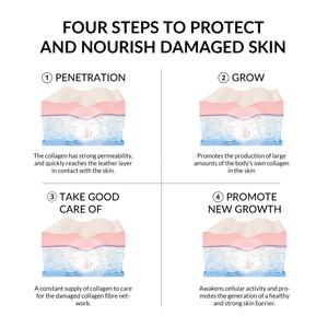 Masques faciaux coréens au collagène les plus vendus – Masque hydratant et éclaircissant à la pastèque pour une peau plus ferme et plus pleine - Product Image 5