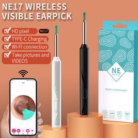 Otoscope sans fil HD pour le retrait du cérumen avec caméra, outil de retrait du cérumen électrique rechargeable par USB, nettoyeur d'oreille intelligent WIFI