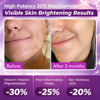 Sérum visage Luxfume Private Label 20% Niacinamide : cible le teint terne, améliore l'inégalité de pigmentation, booste l'éclat de la peau