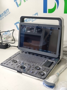 Échographe Doppler Couleur Portable Zoncare M30 avec Imagerie Élastographique pour Examen Cardiaque et Réproductif Vétérinaire - Product Image 2