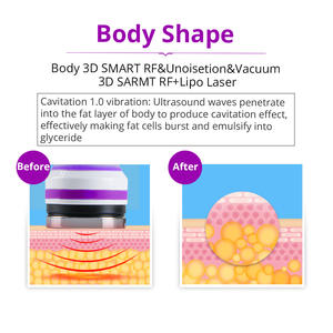 <span class=keywords><strong>Appareil</strong></span> de Massage Minceur et Drainage Corporel par RF à Focalisation Magnétique pour Brûler les Graisses et Remodeler la Silhouette - Product Image 4