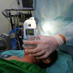 मुख्यधारा etco2 कैप्नोग्राफ पोर्टेबल जेब को2 चिकित्सा और पशु उपयोग के लिए निगरानी - Product Image 4