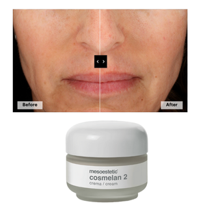 Spot Face Removal <span class=keywords><strong>Mesoestetic</strong></span> <span class=keywords><strong>Cosmelan</strong></span> <span class=keywords><strong>2</strong></span> Set para Cuidado Personal Hogar De España - Product Image 2