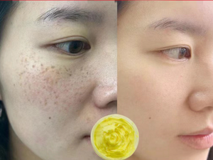 Pele Facial Orgânica Clareamento Mancha Escura Rosto Noite Creme Brilho Hidratante Coreano Nutritivo Noite Creme - Product Image 3