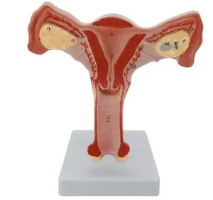 Modèle d'enseignement de l'anatomie utérine féminine, modèle anatomique de l'utérus - Product Image 6