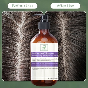 Nhãn hiệu riêng gàu loại bỏ chống gàu dầu gội khô và ngứa cứu trợ cho khô và ngứa da đầu khô da đầu điều trị - Product Image 3