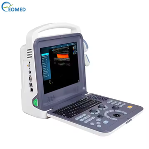 पोर्टेबल रंग डॉपलर नैदानिक अल्ट्रासाउंड स्कैनर चिकित्सा अल्ट्रासाउंड मशीन क्यू28 - Product Image 2