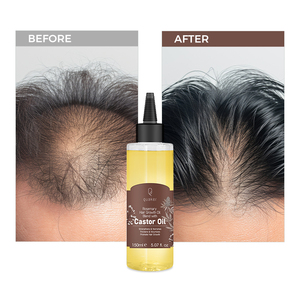Qquaker <span class=keywords><strong>Aceite</strong></span> <span class=keywords><strong>De</strong></span> Romero Para El Crecimiento Del Cabello <span class=keywords><strong>Aceite</strong></span> <span class=keywords><strong>De</strong></span> <span class=keywords><strong>Ricino</strong></span> <span class=keywords><strong>Aceite</strong></span> <span class=keywords><strong>De</strong></span> Crecimiento Del Cabello Para Hombres <span class=keywords><strong>Aceite</strong></span> <span class=keywords><strong>De</strong></span> Cabello Orgánico - Product Image 4