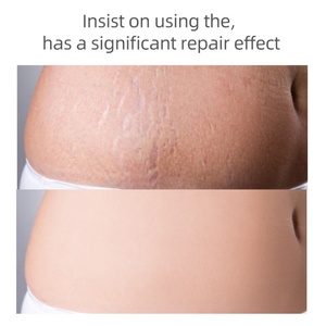 Autocollants personnalisés, crème anti-vergetures, soins de grossesse, produits pour femmes enceintes, produits de santé - Product Image 2