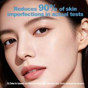 Suero para el Tratamiento del Acné con Mejora de la Piel en 4 Semanas, Reduce el 90% de las Imperfecciones de la Piel, Refina los Poros y Suaviza la Piel Áspera - Product Image 4