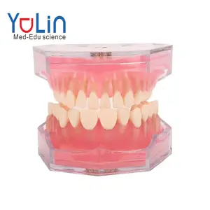 Comunicación del médico oral con el modelo dental del paciente Modelo de extracción de goma blanda Modelo de diente de resina Modelo de caries dental