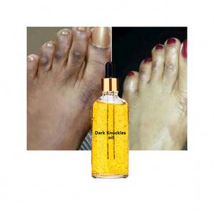 Aceite <span class=keywords><strong>de</strong></span> Rosa Negra Hidratante Corrector <span class=keywords><strong>de</strong></span> Manchas Oscuras Iluminador que Ayuda a Reducir los Signos <span class=keywords><strong>de</strong></span> Envejecimiento, el Enrojecimiento y <span class=keywords><strong>la</strong></span> Reparación <span class=keywords><strong>de</strong></span> <span class=keywords><strong>la</strong></span> <span class=keywords><strong>Piel</strong></span> Propensa al Acné - Product Image 1