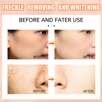 Crème éclaircissante anti-taches Eelhoe à la vitamine C, pour éliminer le chloasma, réparer les coups de soleil, hydrater et éclaircir la peau.