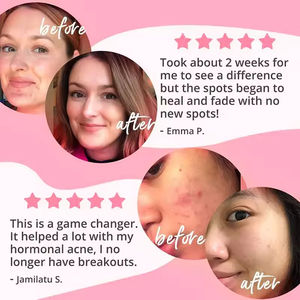 Kapsul Kolagen OEM/ODM 14-in-1 Alami Tipe I, II, III, V dan <span class=keywords><strong>X</strong></span> Pemutih Kulit dengan Biotin & Keratin Dengan Asam Hialuronat - Product Image 5