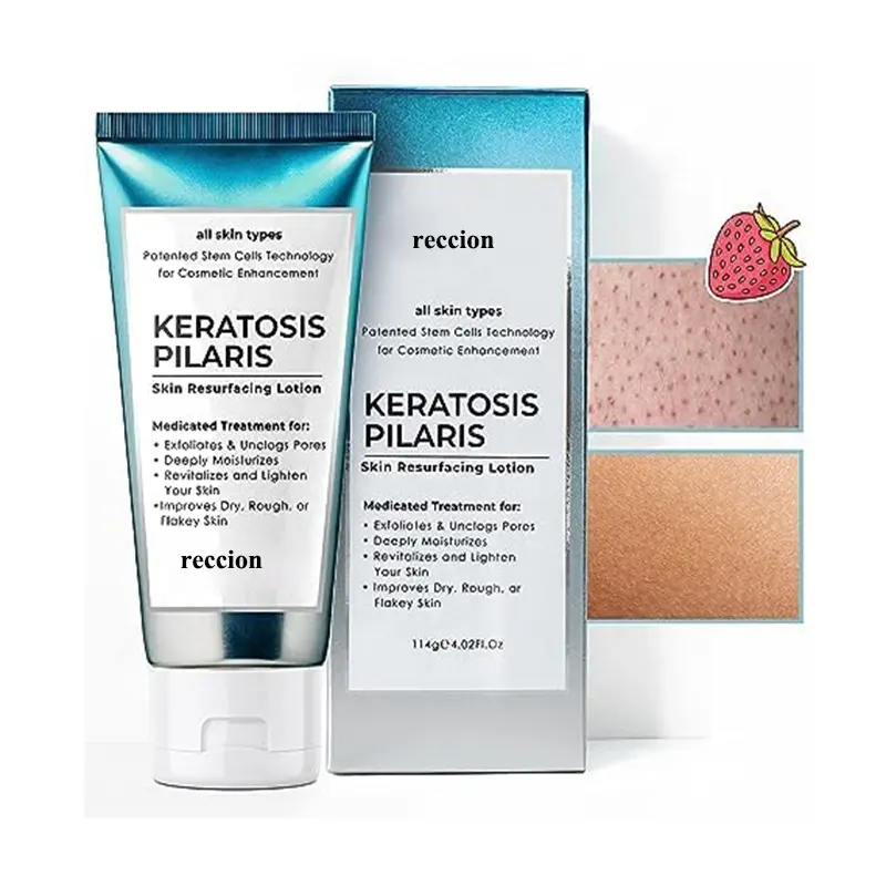 Aardbeienpoten Kp Ingegroeide Haarbehandeling Hobbelige Huid Bodylotion Glycolzuur, Aha & Bha Exfoliërende Keratosis Pilaris Lotion