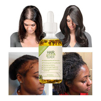 Sérum-Huile Capillaire Végétalien Unique Traitant la Perte de Cheveux avec Gingembre et Romarin, Accélérateur de Croissance Naturel pour le Cuir Chevelu (OEM/ODM Disponible)